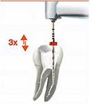 Instrumenty RECIPROC / 6 szt.