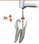 Instrumenty RECIPROC / 6 szt.