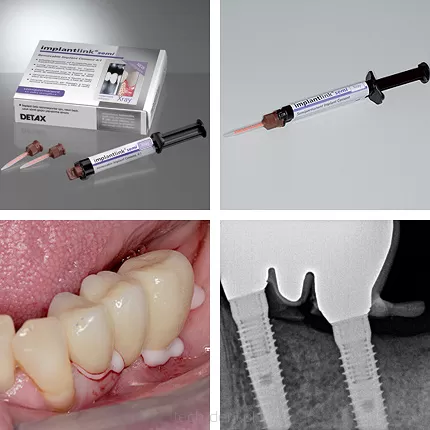 Implantlink Semi Xray Forte / strzykawka 5ml