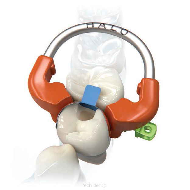 Halo Universal Molar Ring / 2szt.