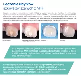Icon Vestibular - infiltracja próchnicy - powierzchnia przedsionkowa (policzkowa) / pojedyńczy zestaw leczniczy (1 unit)