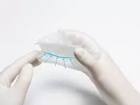 OptraGate® 2 / rozwieracz jamy ustnej / 1 szt.